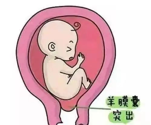 【健康科普】艰难孕路上的荆棘草 ——宫颈机能不全（一）