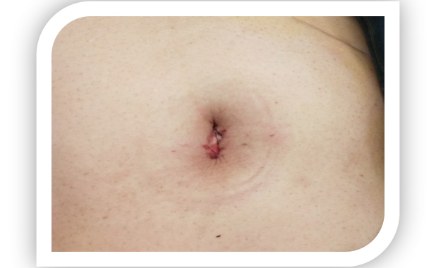 特色医疗——妇二科系列