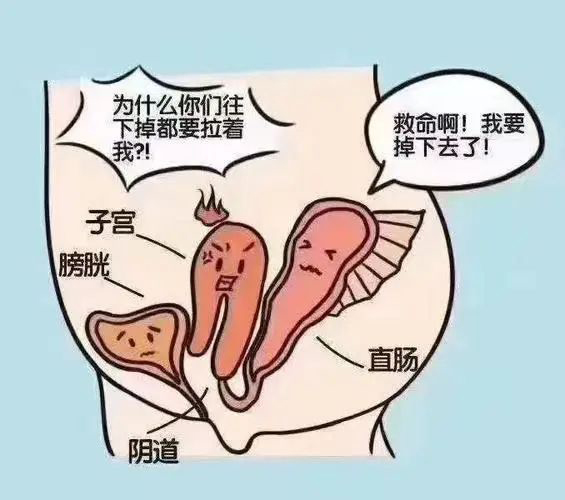 【健康科普】盆腔器官脱垂的防与治