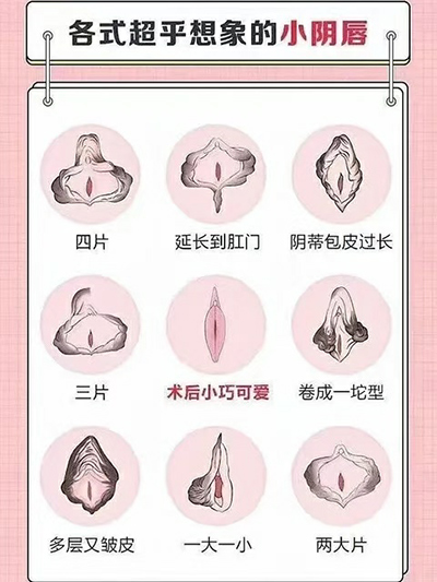 【优势专科】暑假来临，开启私密健康计划