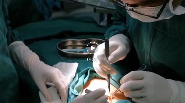 【优势技术】宝宝疝气不用愁，小儿微创手术全解读（家长版）