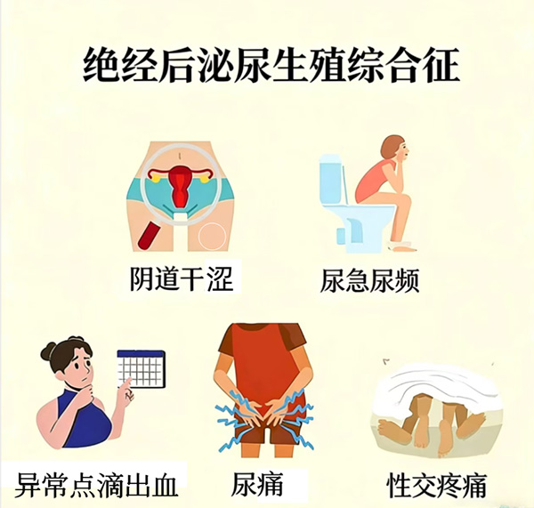 【健康科普】绝经生殖泌尿综合征（GSM）：绝经后女性不可忽视的“难言之隐”