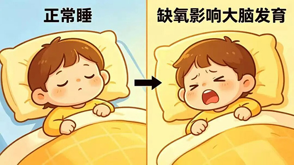 【健康科普】孩子打鼾别硬扛，腺样体手术别等，耽误的是颜值和智商！